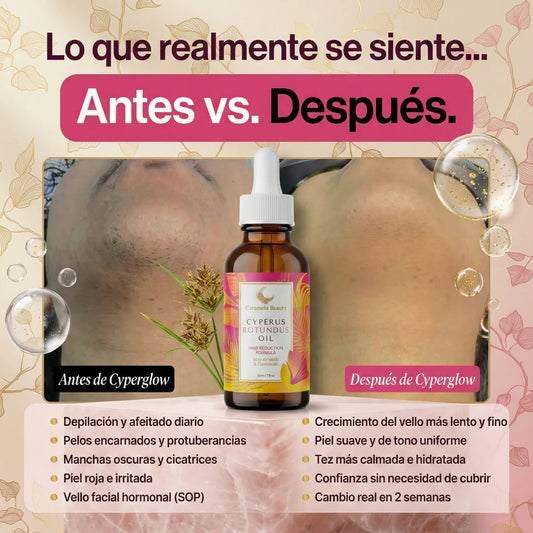 Cyperus Rotundus Oil (60 ml) | Piel Suave y Menos Vello de Forma Natural